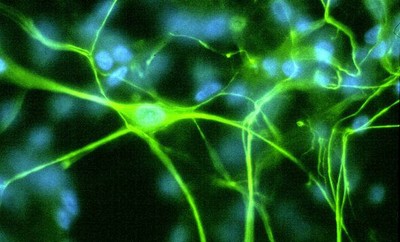 Synapse-1.jpg